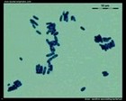 Gram positive sporulating bacterium microscopy